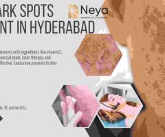 Dark Spots Treatment in Hyderabad